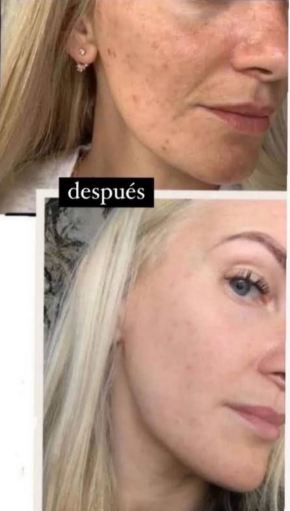 Lumispa iO